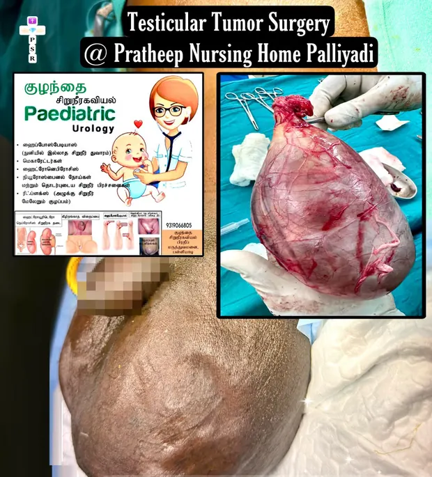 Operative photograph from testicular tumour surgery