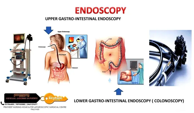 Illustrated chart explaining upper gastro-intestinal endoscopy and colonoscopy
