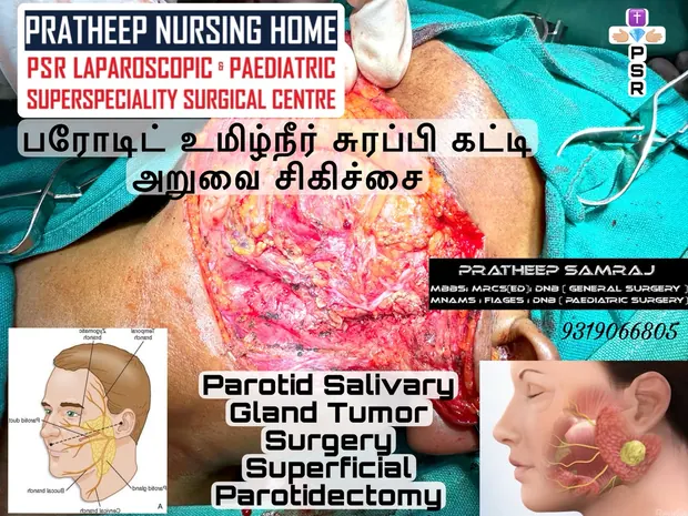 Operative photograph from tumour surgery
