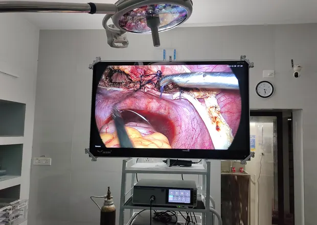 Operation theatre at Pratheep Nursing Home with a laparoscopic view on the 55-inch 4K surgical monitor